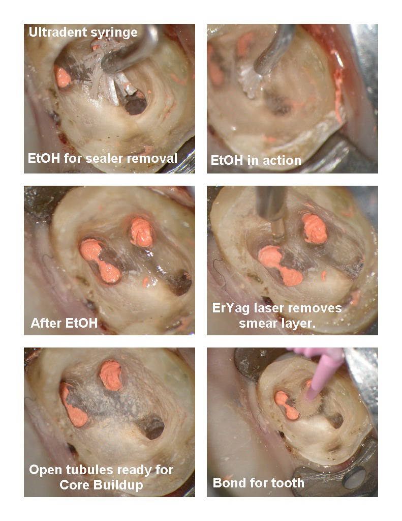 Endo first molar pg 4.jpg